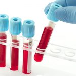 BloodTest BloodTest