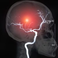 BrainIssue BrainIssue